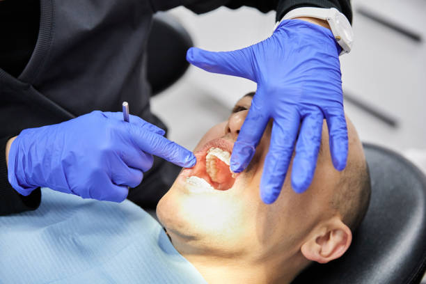 Best Emergency Treatment for Dental Infections or Abscesses in Waterloo, IA